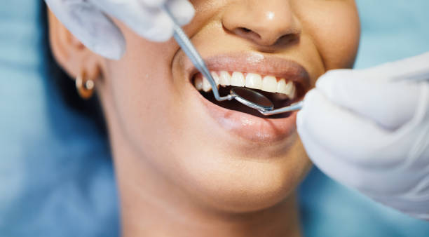 Best Emergency Wisdom Tooth Extraction in Clayton, NM